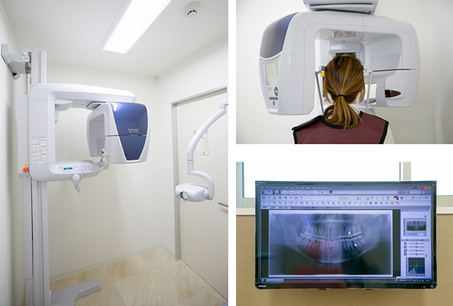 歯科用CT