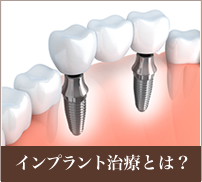 インプラント治療とは？