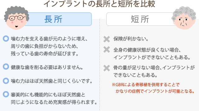 インプラントの長所と短所を比較